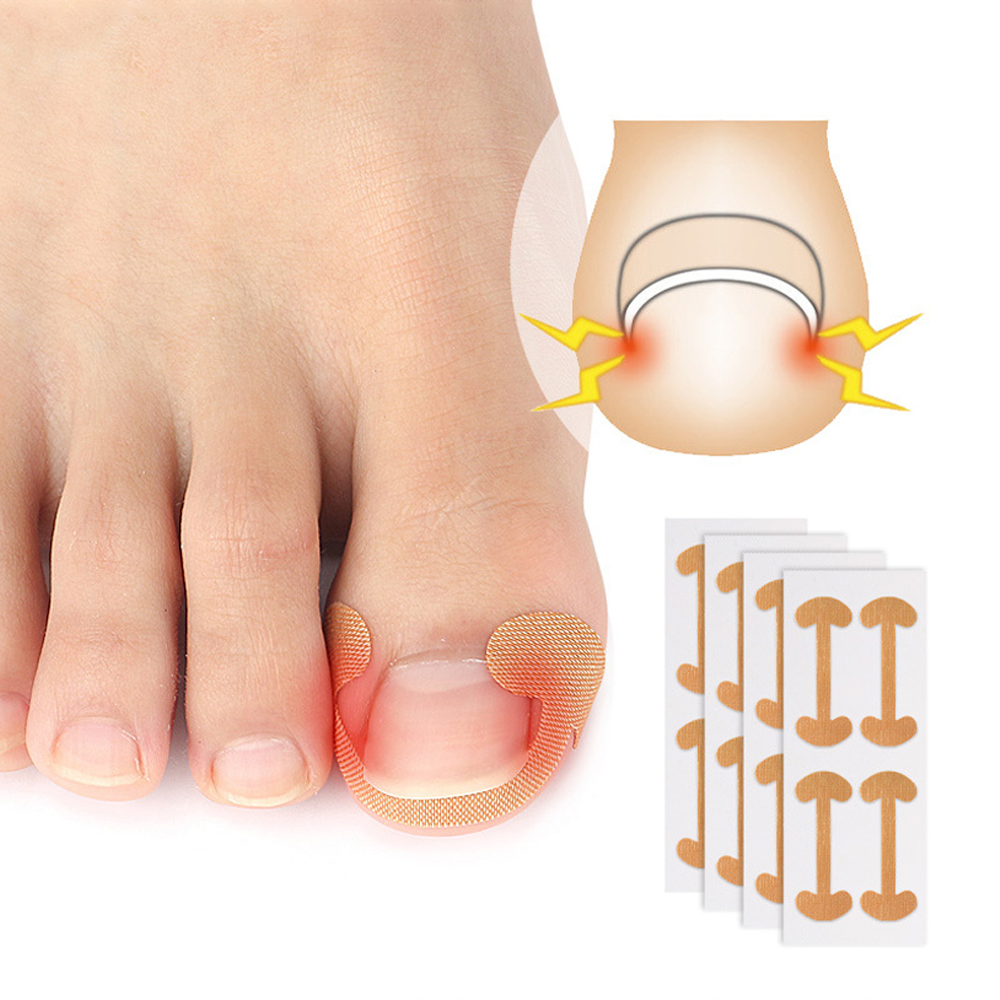 닥터크랄레 셀프 내성발톱 테이프 파고드는발톱 (120개입)